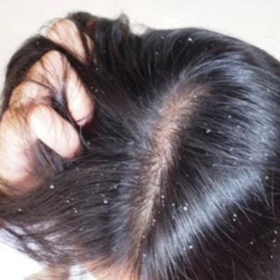 Anti hair fall, Anti dandruff. Pakistan’s best-kept secret herbal formula-200ml
