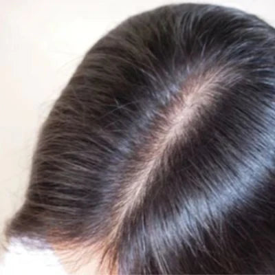 Anti hair fall, Anti dandruff. Pakistan’s best-kept secret herbal formula-200ml