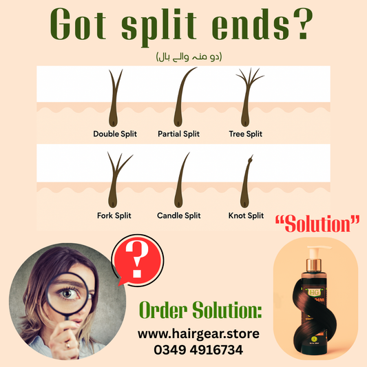 Anti hair fall, Anti dandruff. Pakistan’s best-kept secret herbal formula-200ml