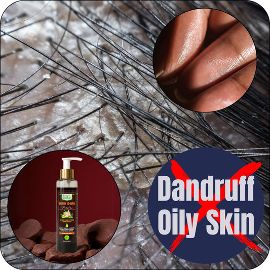 Anti hair fall, Anti dandruff. Pakistan’s best-kept secret herbal formula-200ml